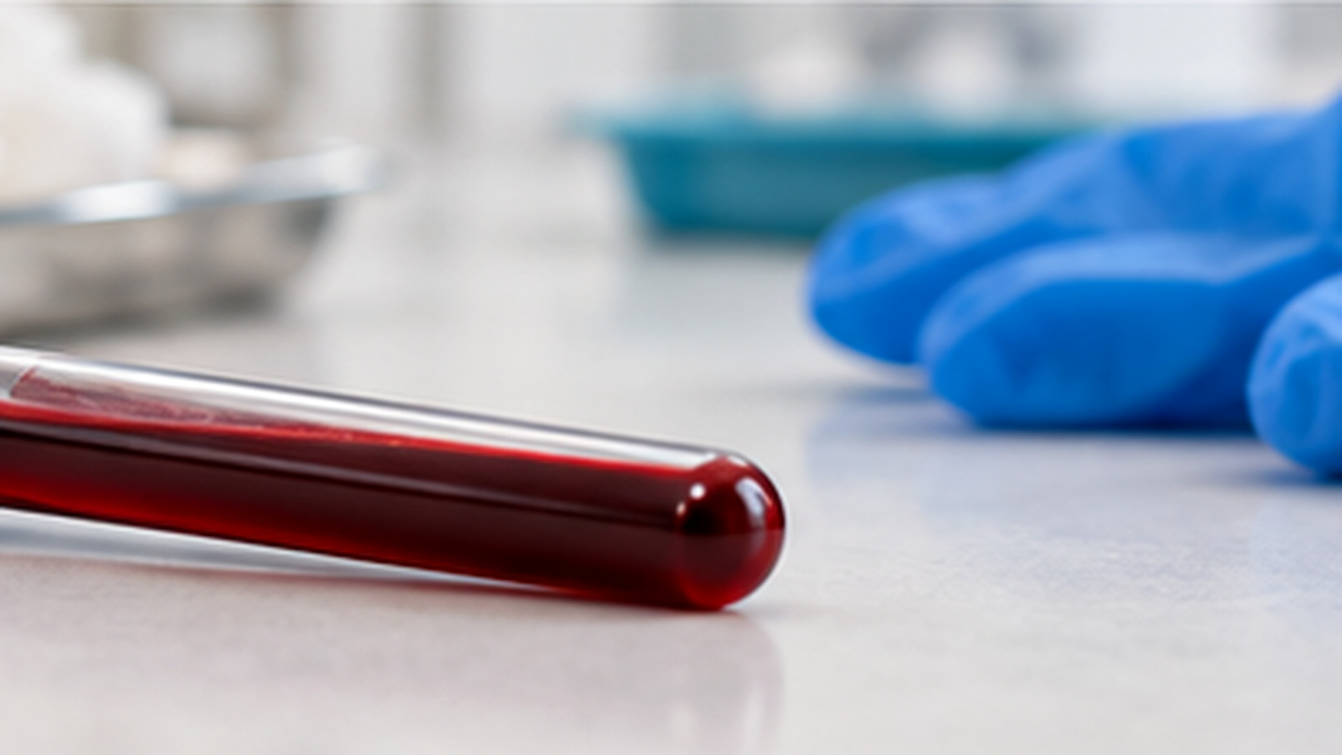 Tryptase Blood Test: High Levels and Allergy Timing Guide