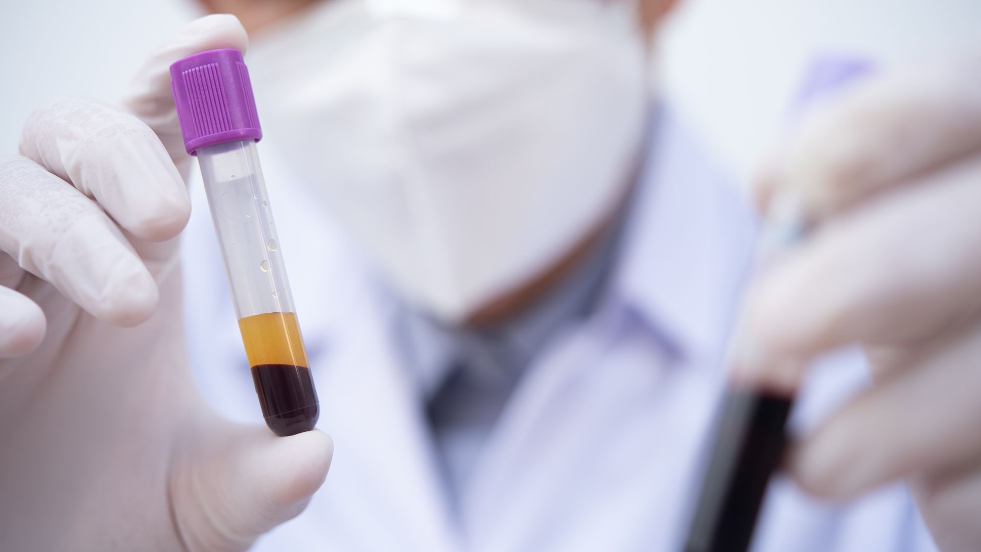 Thyroid Blood Test: TSH, T4, T3 and Antibodies Test Guide